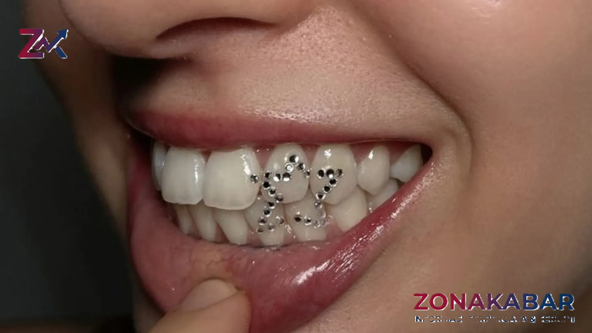 Kilau Estetika di Balik Senyuman: Mengupas Fenomena Tooth Gem yang Menjadi Obsesi Baru Gen Z